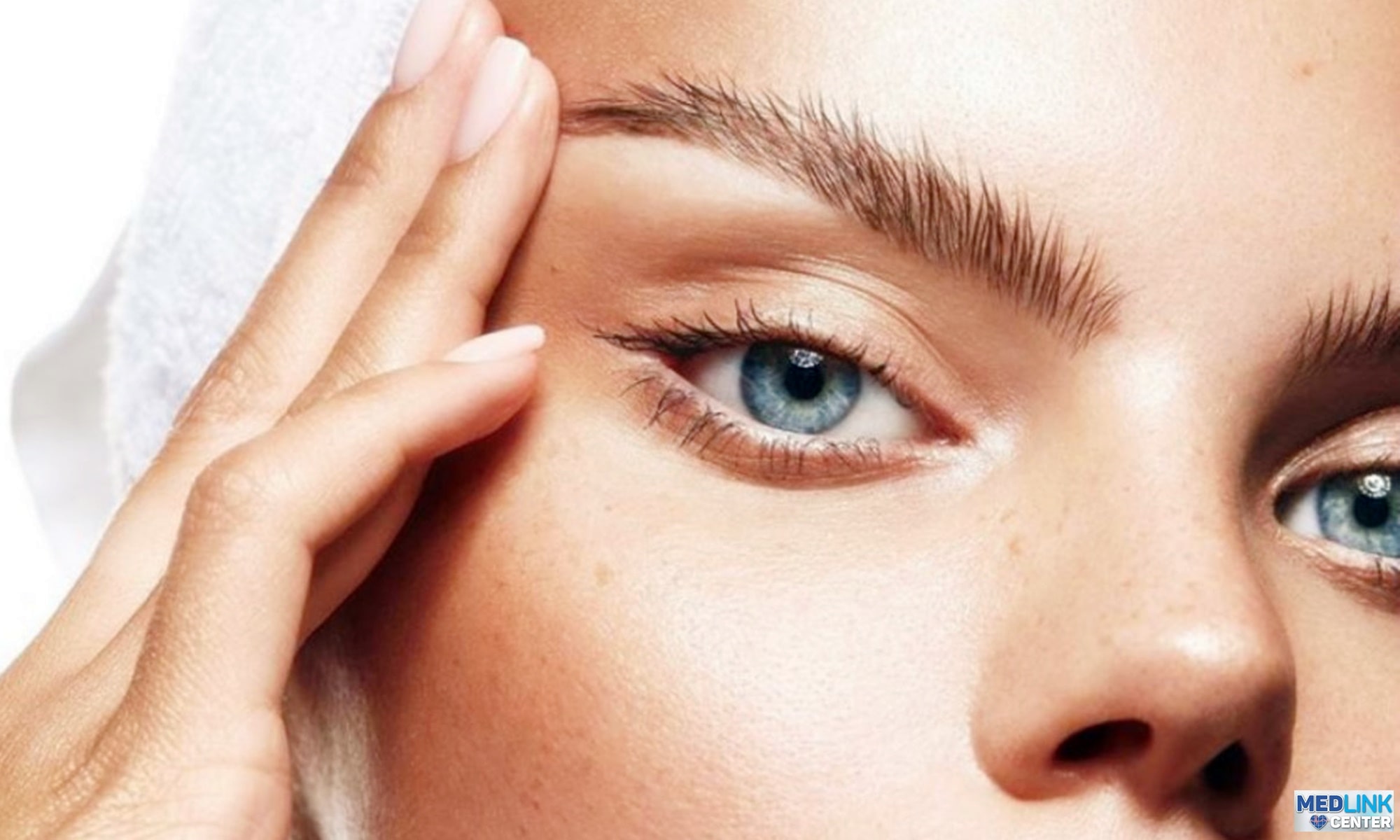 Botox pentru ridicarea sprâncenelor