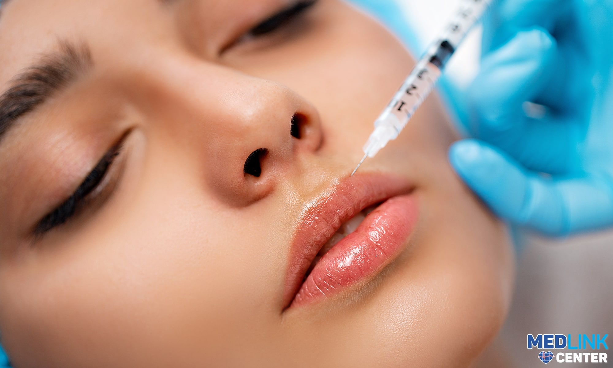 Fillerele cu acid hialuronic Juvederm