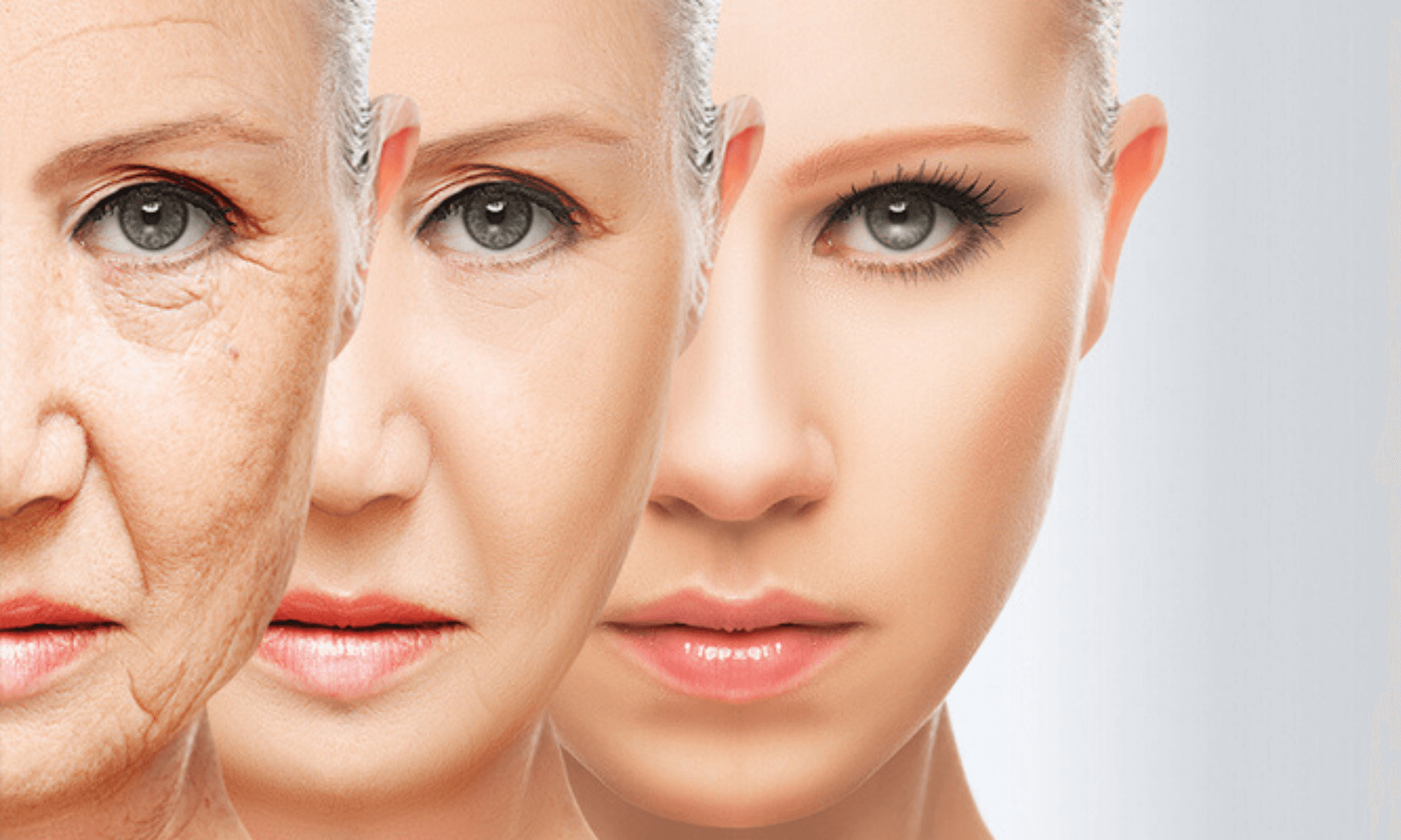 lifting facial lifting facial noninvaziv