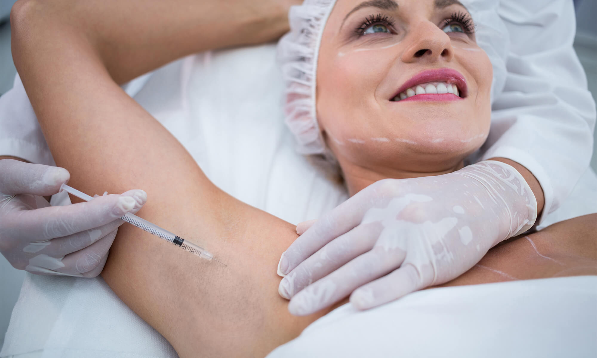 hipersecretie glande sudoripare hiperhidroza tratament botox toxina botulinica medlink center craiova dermatologie estetica